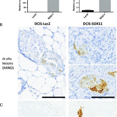 Downstream Effectors Of Sox Signalling Identified In A Mouse Model Of