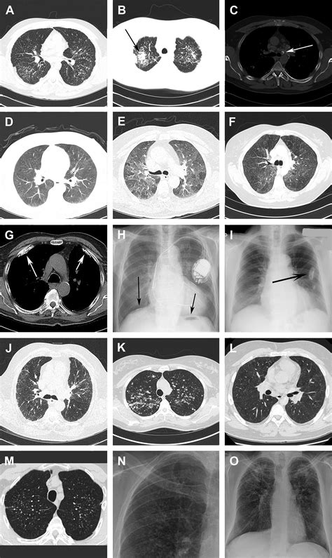 Occupational Lung Disease Medical Clinics