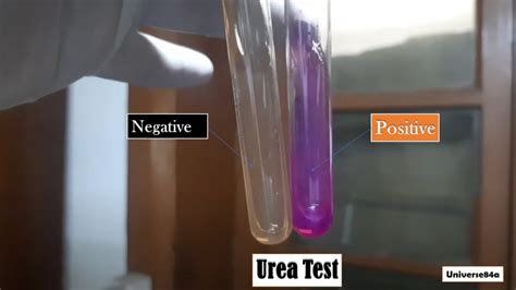 Urea Test: Principle, Procedure, Interpretation, Urease Positive Organisms,