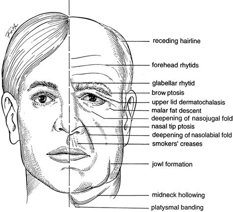 Faith Wong • Anatomy Of Facial Aging My Sculpts Are Based On