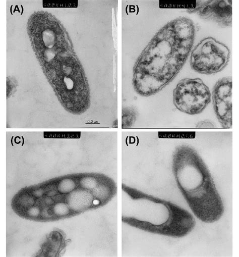 Ultrastructure Of Actively Growing Cells A Vbnc Cells In Microcosm