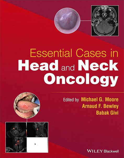 Essential Cases In Head And Neck Oncology 9781119775942 Medicine