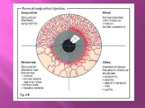 Opthalmolgythe Conjunctiva Lecture 1drali