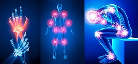 Conoce Los S Ntomas Tipos Y Causas Del Dolor Articular Aldia