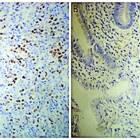 Chromogenic In Situ Hybridization For Epstein Barr Virus Encoded Rna Download Scientific