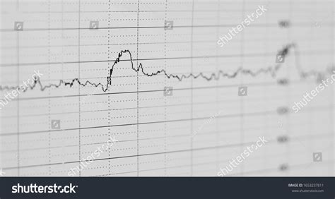 ecg graph electrocardiogram ekg  paper stock photo