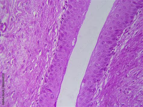 Transitional Epithelium Slide 400x