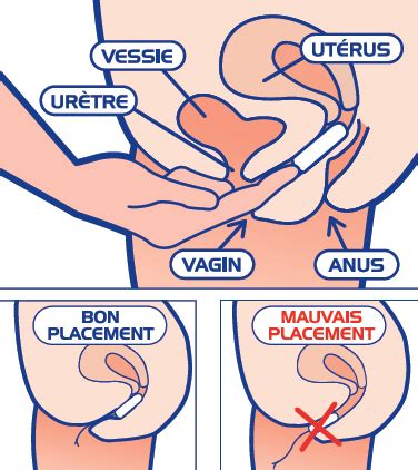 Comment Mettre Un Tampon Id Vie