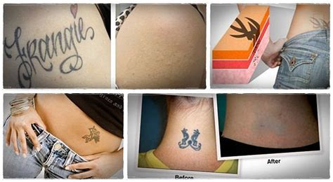 Step By Step Natural Tattoo Removal How To Remove Tattoos At Home