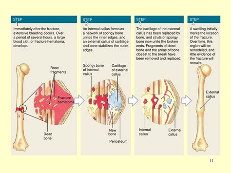 Powerpoint Presentation To Accompany Holes Human Anatomy And