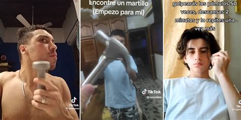 Bone Smashing El Peligroso Reto De TikTok De Moldearse La Cara Con