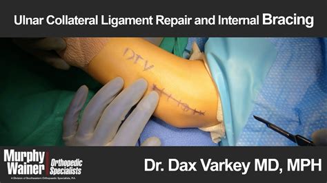 Elbow Ulnar Collateral Ligament Repair And Internal Bracing Youtube