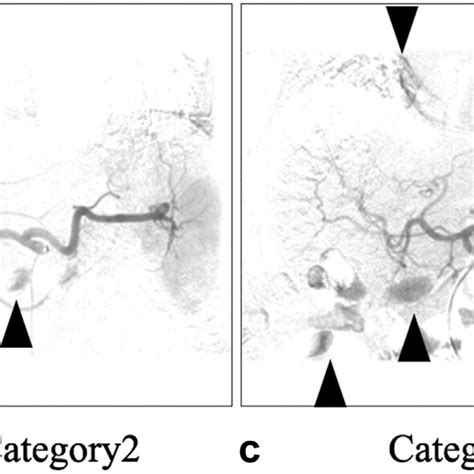 Figure E1 Examples Of Each Classification Of Motion Artifacts