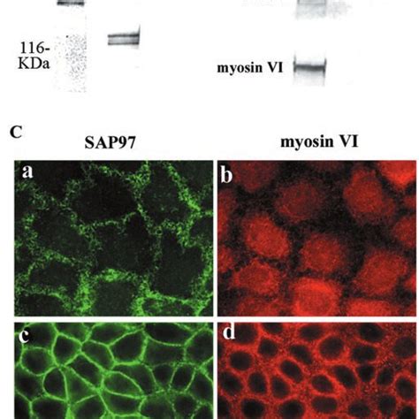 Inhibiting Myosin VI Expression Impedes Cell Migration Equivalent