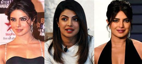 Priyanka Chopra Plastic Surgery Before And After Pictures 2024