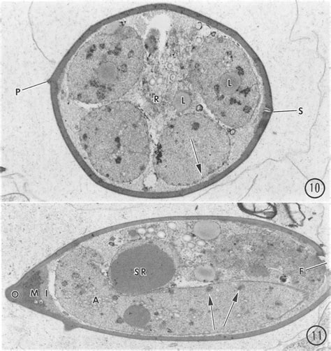 11 Eimeriafunduli 10 Diagonal Section Of Sporocyst With The Two