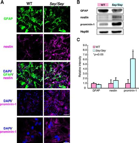 Cultured Pax6 Deficient Astrocytes Are Immature And Express Neural