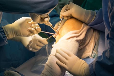 Acl Reconstruction Melbourne Malvern And Werribee Moati