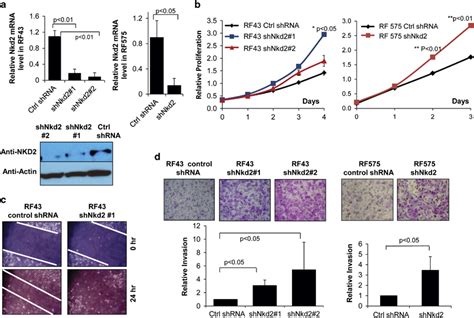 NKD2 Depletion In Non Metastatic OS Cell Lines Enhances Cell