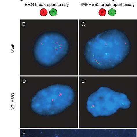 PDF Molecular Characterization Of TMPRSS2 ERG Gene Fusion In The NCI