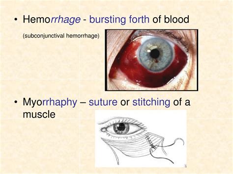 Ppt Medical Terminology Powerpoint Presentation Free Download Id