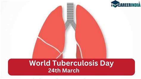 World Tuberculosis Day 2023 Date Theme History Importance And Facts Alam Blogg