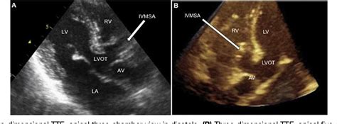 Figure 1 From Multimodal Imaging Characterization Of A Congenital