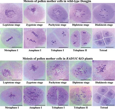 Plant Cell Anaphase