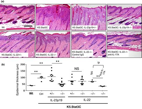 Mouse Models Of Psoriasis And Their Relevance Nakajima The