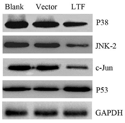 Protein Expression Levels Of P38 JNK2 C Jun And P53 In The Gastric