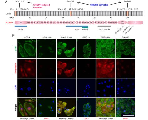 Cardiomyocytes Differentiated From Dystrophin Deficient Ipscs A