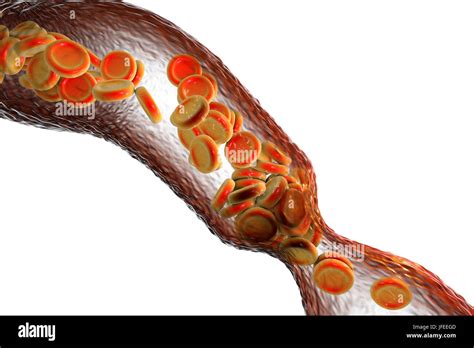 Blood Vessel Hi Res Stock Photography And Images Alamy