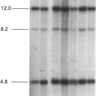 Examples Of Pfge Patterns Obtained Following Digestion Of N