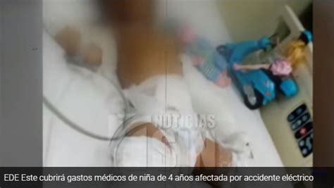 EDEEste cubrirá gastos médicos de niña afectada por accidente eléctrico