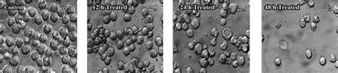 Morphological changes of K562 cells treated with CBX. K562 cells ...