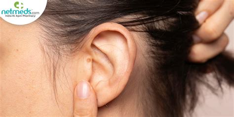 Cancerous Lumps Behind Ear