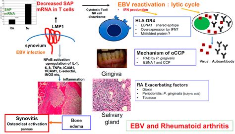 Viruses Free Full Text Are Viral Infections Key Inducers Of Autoimmune Diseases Focus On