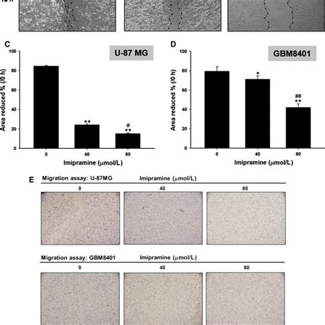 Cell Mobility Migration And Invasion Ability Of Glioblastoma Cells