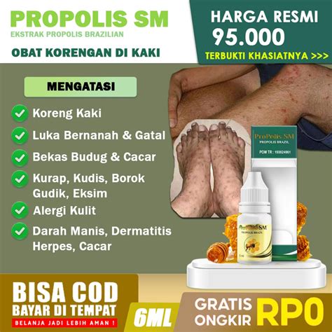 Jual Propolis SM Obat Koreng Di Kaki Kepala Pantat Bernanah Dermatitis