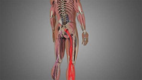 Radiculopathy Lumbar Region