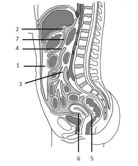 rr peritoneum Diagram | Quizlet