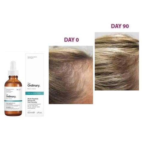 The Ordinary Multi Peptide Serum For Hair Density 60ml Simply Glow