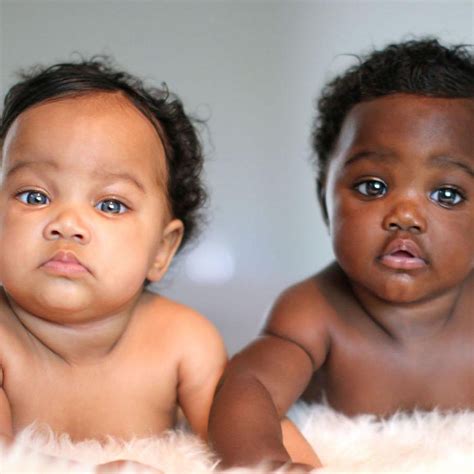 Twins Born With Different Color Skintones Win Over Our Hearts Proving