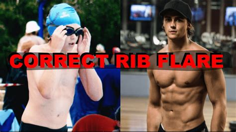 How To Fix Pectus Excavatum Rib Flare Youtube