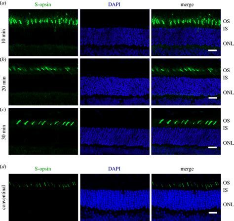 Immunohistochemical Study Of Retinal Sections To Label Cone