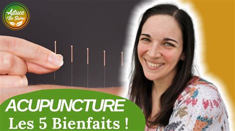 Acupuncture les 5 bienfaits L acupuncture une médecine naturelle aux