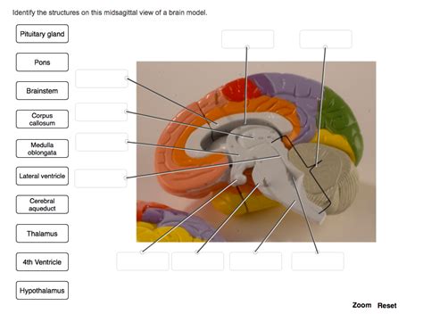 Brain Midsagittal View Labeled