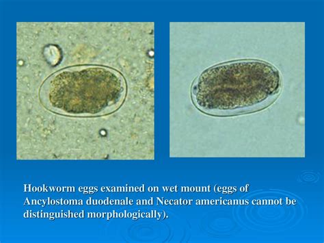 Ancylostoma Duodenale Ova