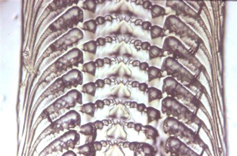 Mollusc Radulae from microscope slides at the Booth Museum, Brighton