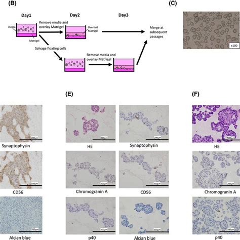 Established Organoid Maintains The Histological Architecture And